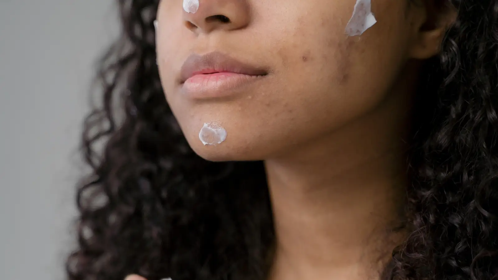 The Dark Spots That Natural Remedies Can Actually Fade—And How