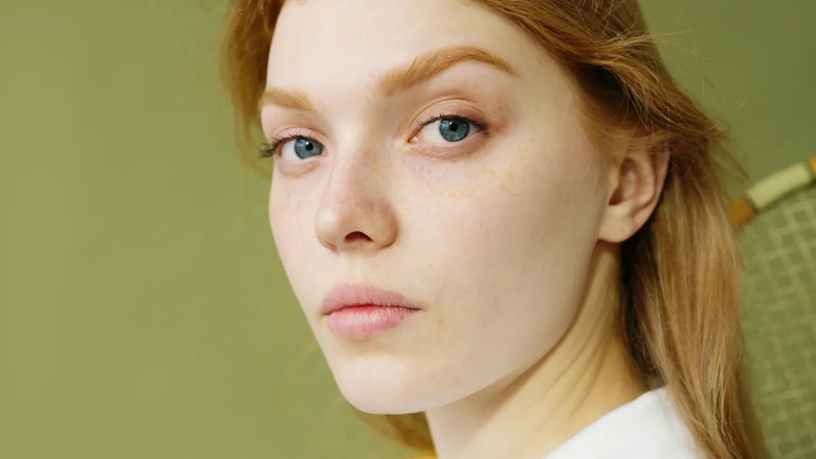 5 Times a Chemical Peel Beats Laser for Dark Spots