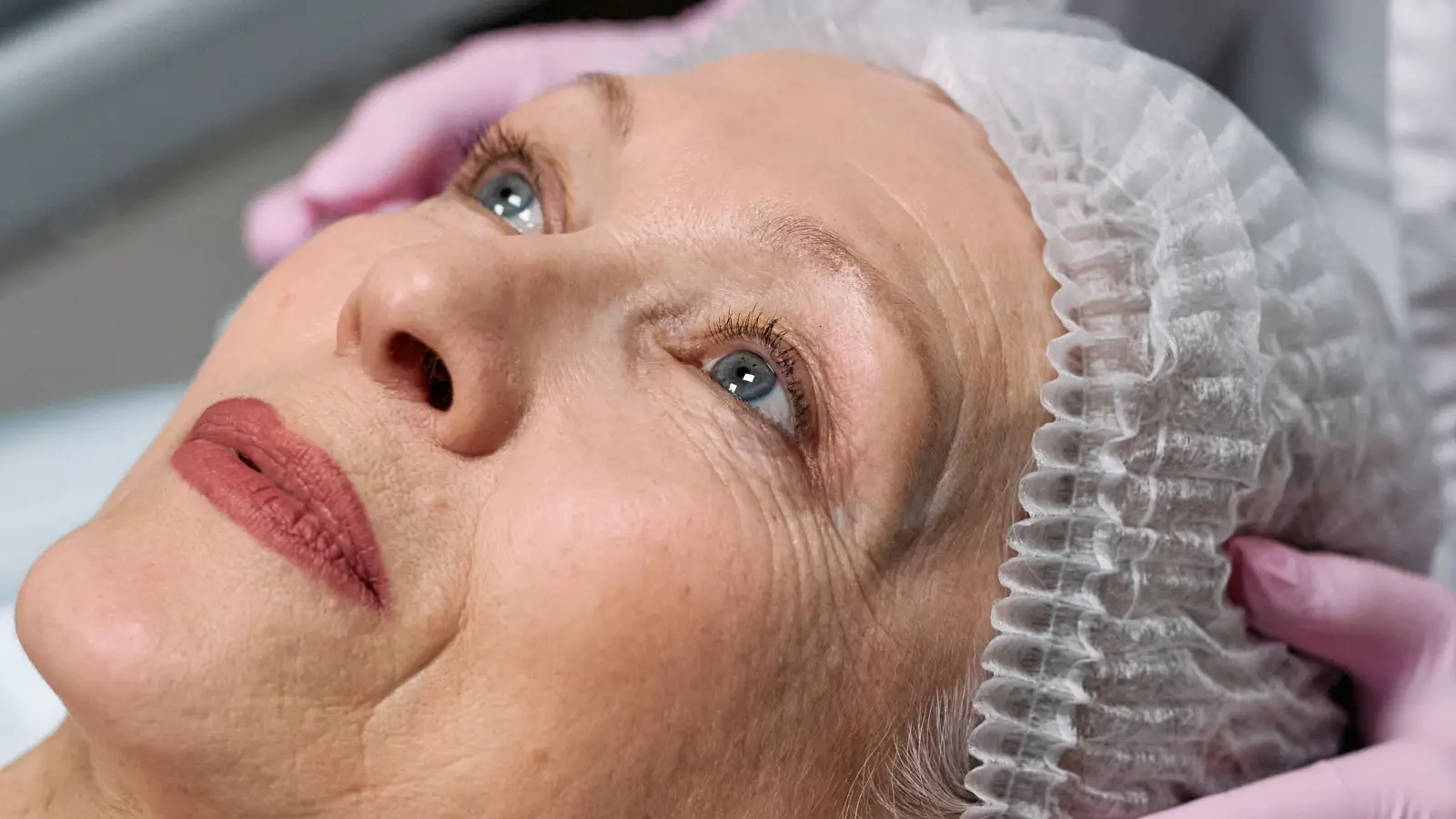 4 Sessions, $1,200: The Real Cost of Age Spot Removal