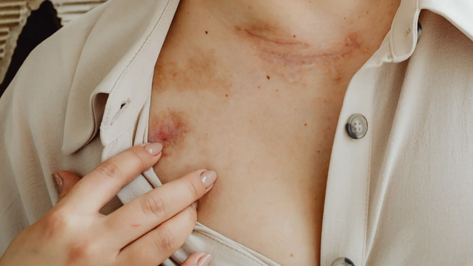 Fraxel Healing: Your 7-Day Recovery Roadmap