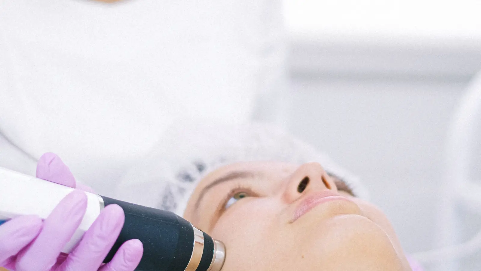 How Dermatologists Use Q-Switched Laser to Target Pigment