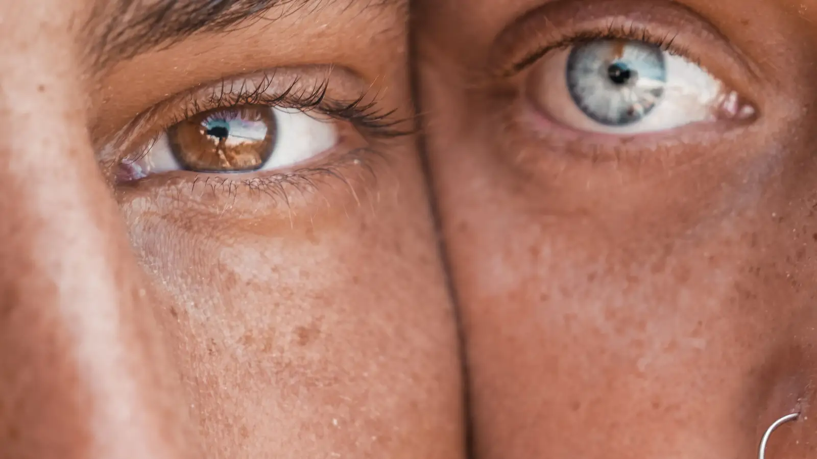 If You Have Olive or Brown Skin, Here's Why Melasma Appears