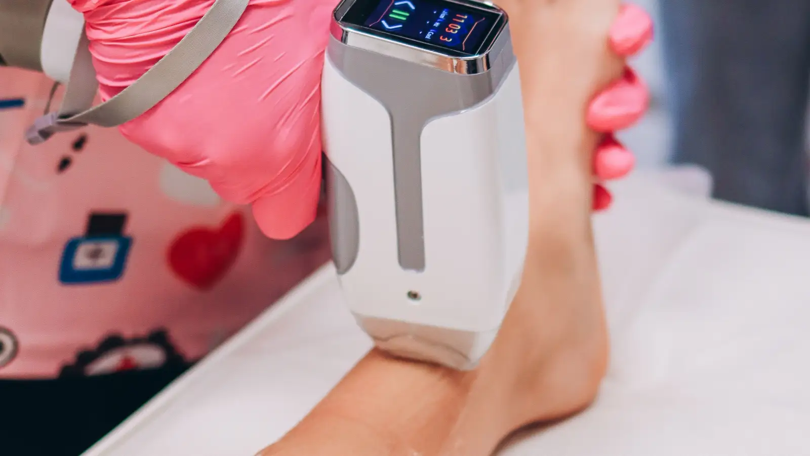Laser, Peel, or Cream: Real Hyperpigmentation Cost by Type