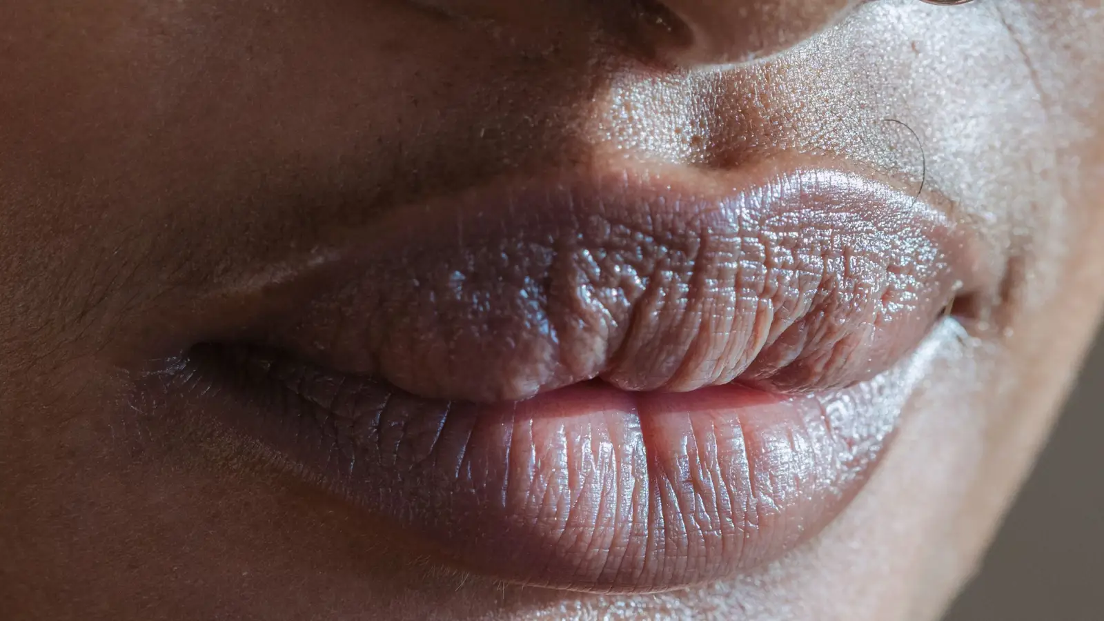 For Melanin-Rich Skin: Safe Spot Treatment Selection