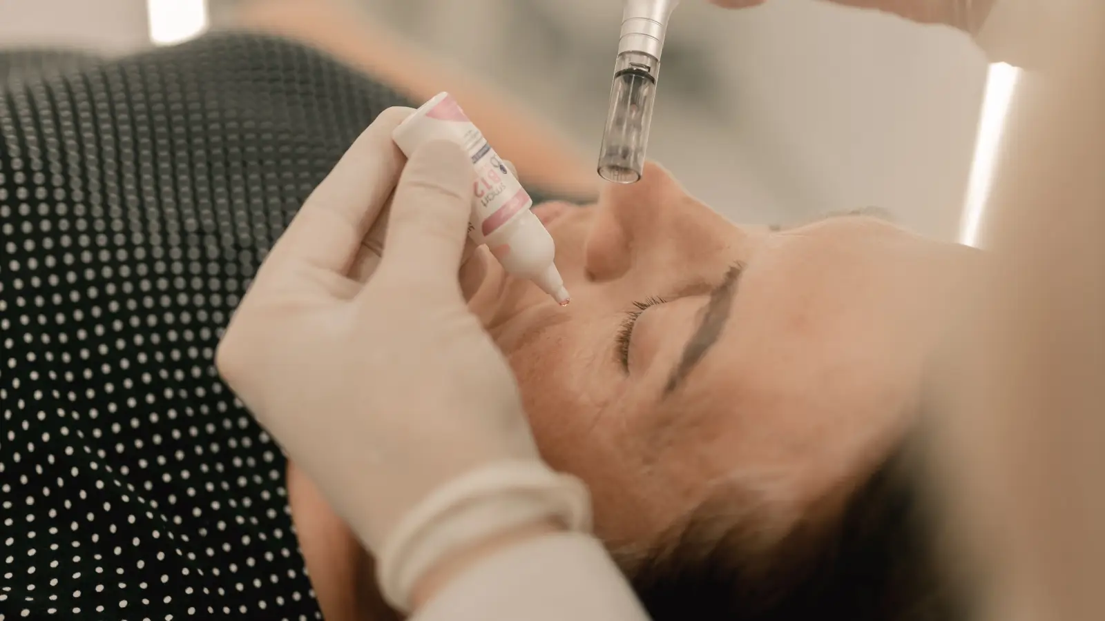 Microneedling for dark spots? Not all types respond.