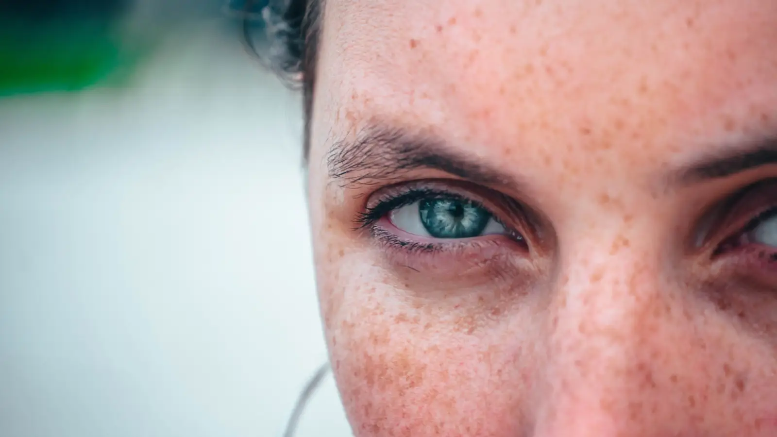 How Natural Dark Spot Remedies Can Backfire (And How to Prevent It)
