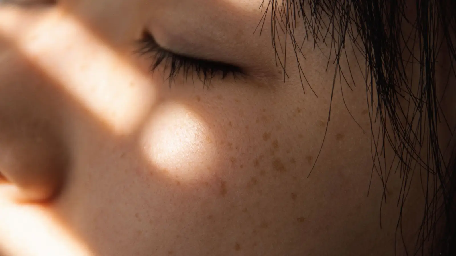 The overlooked step that doubles microneedling's spot-fading power