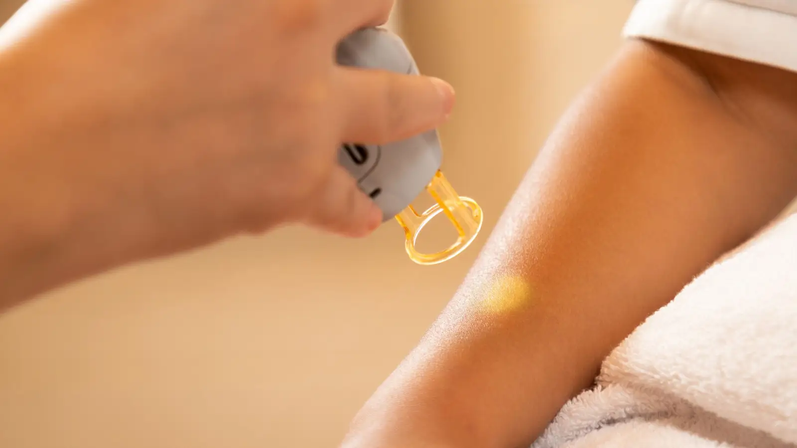 Solar Lentigo, Melasma, or PIH: Which Responds to Laser Removal?