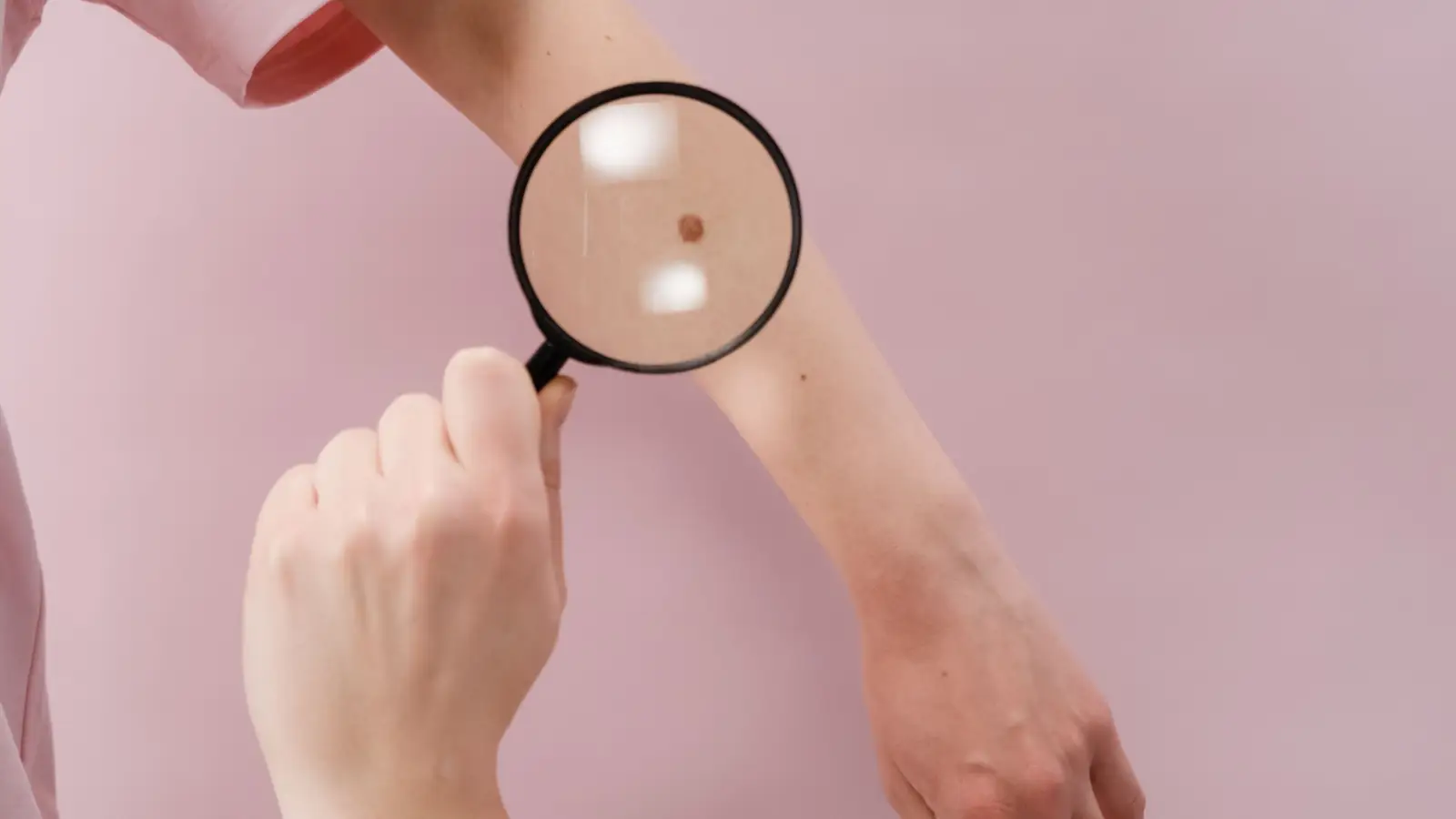 3 Pigment Depths That Decide Your Spot Treatment Success