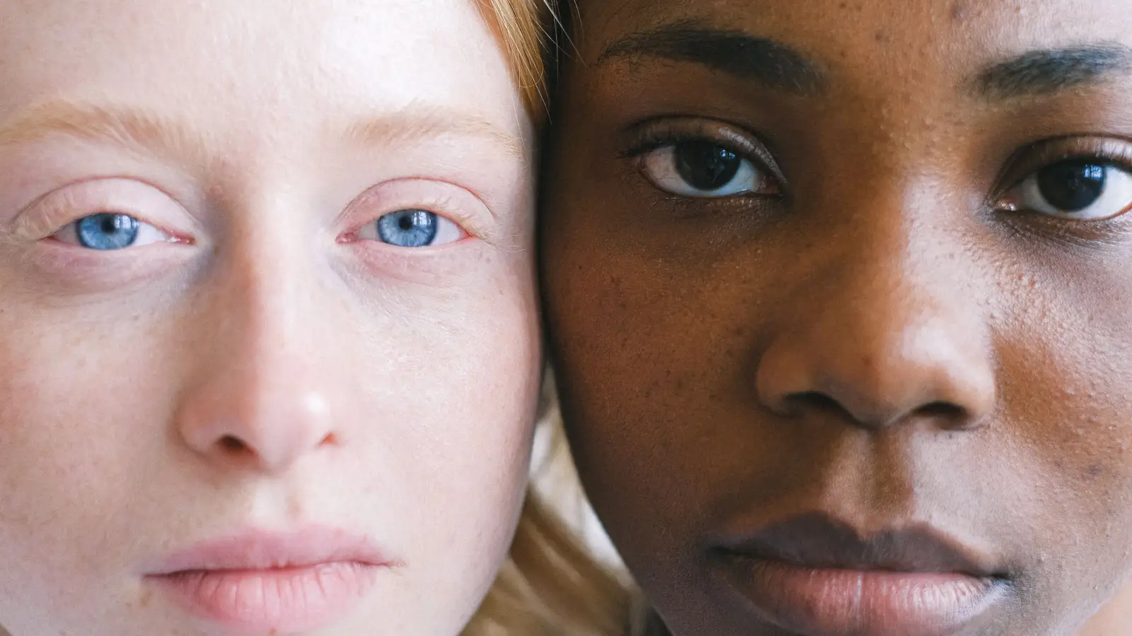 What top derms pick for dark spots: microneedling vs. peel vs. laser