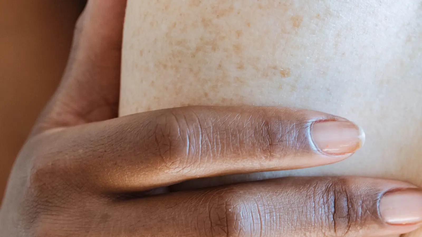 What Dermatologists Check About Your Skin Tone Before Treating Spots