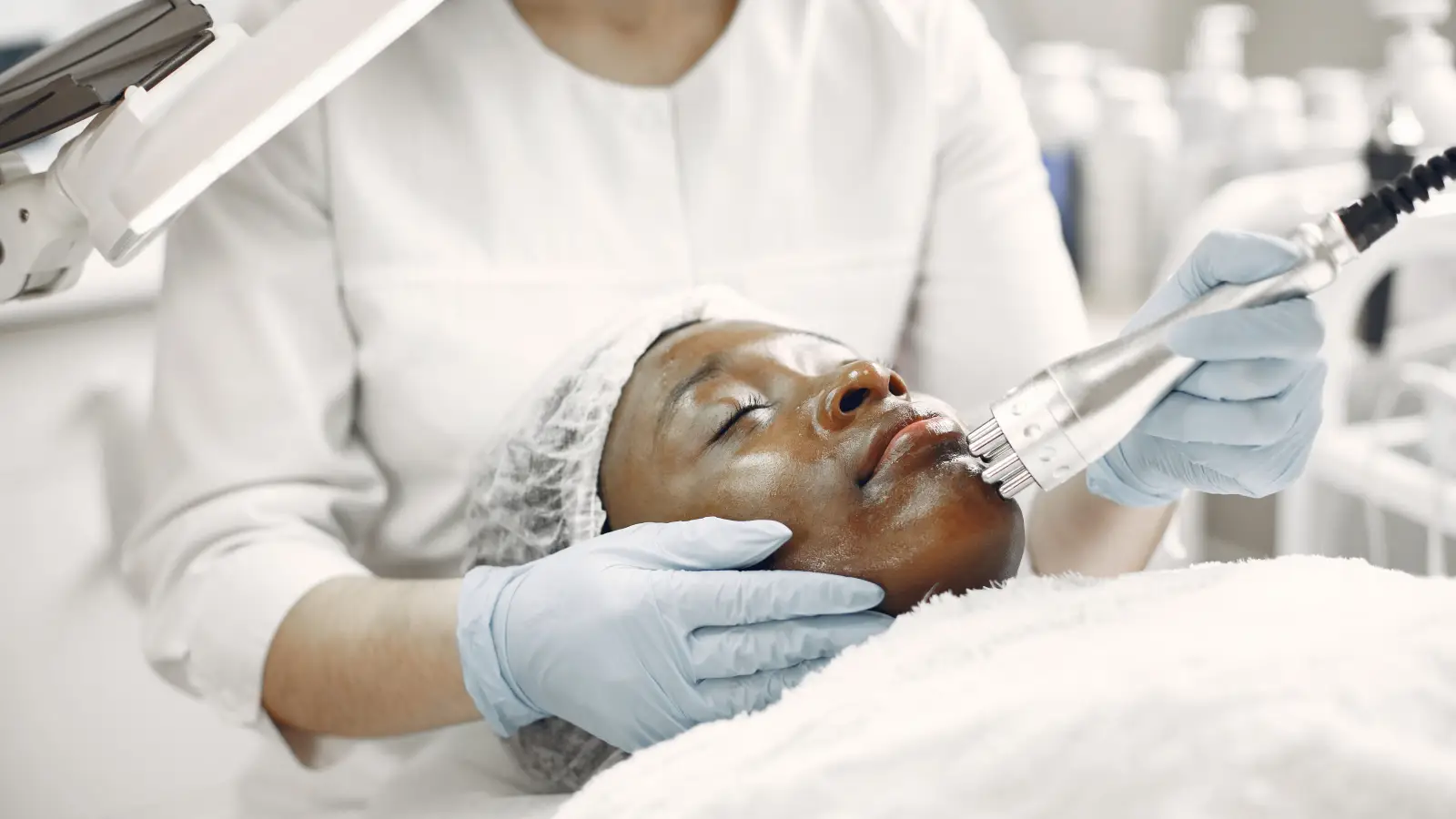 What Dermatologists Verify Before Using Lasers on Darker Skin Tones