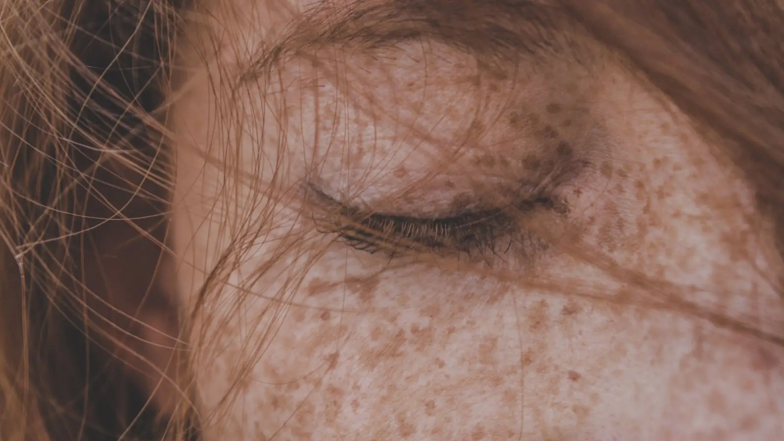 Why Your 'Age Spot' Is Probably Not an Age Spot