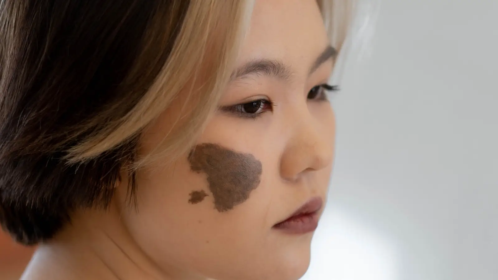 Why Your Melasma Won't Stay Gone—The Mistake You're Making