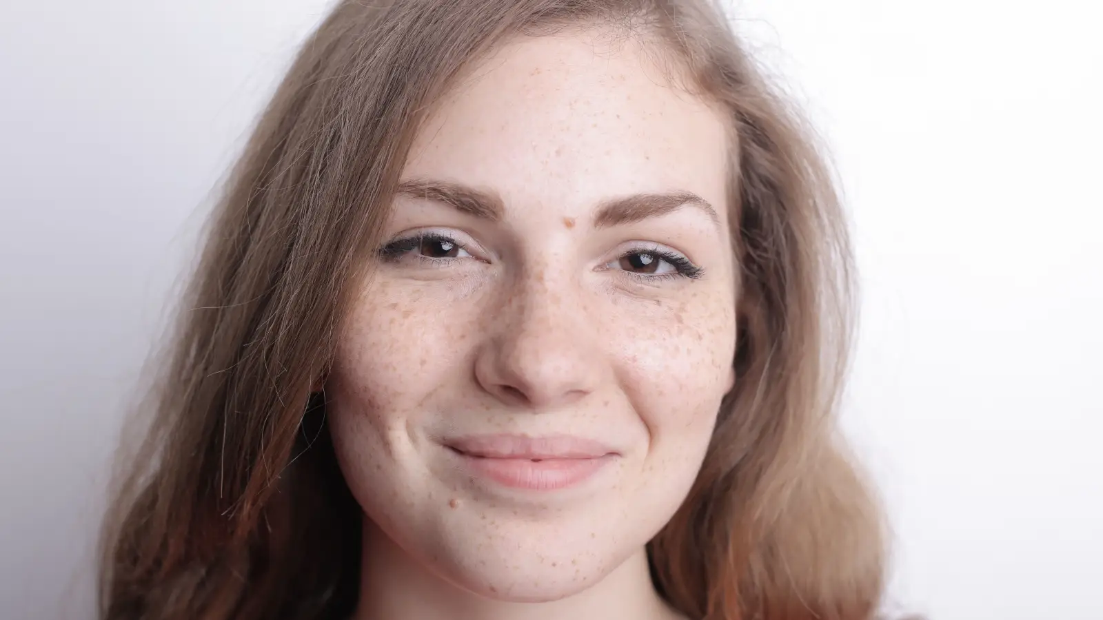 Is Your Face Spot a Sun Spot or Melasma? How to Tell